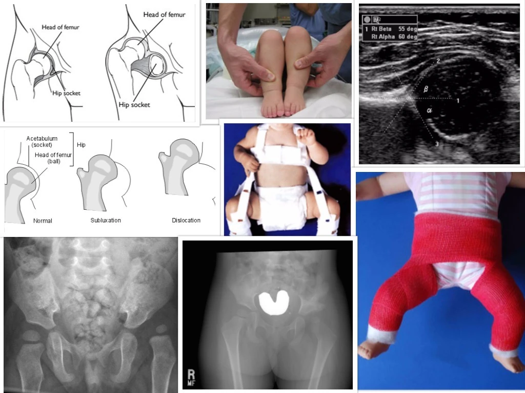 Children's Orthopaedic Outreach Programme